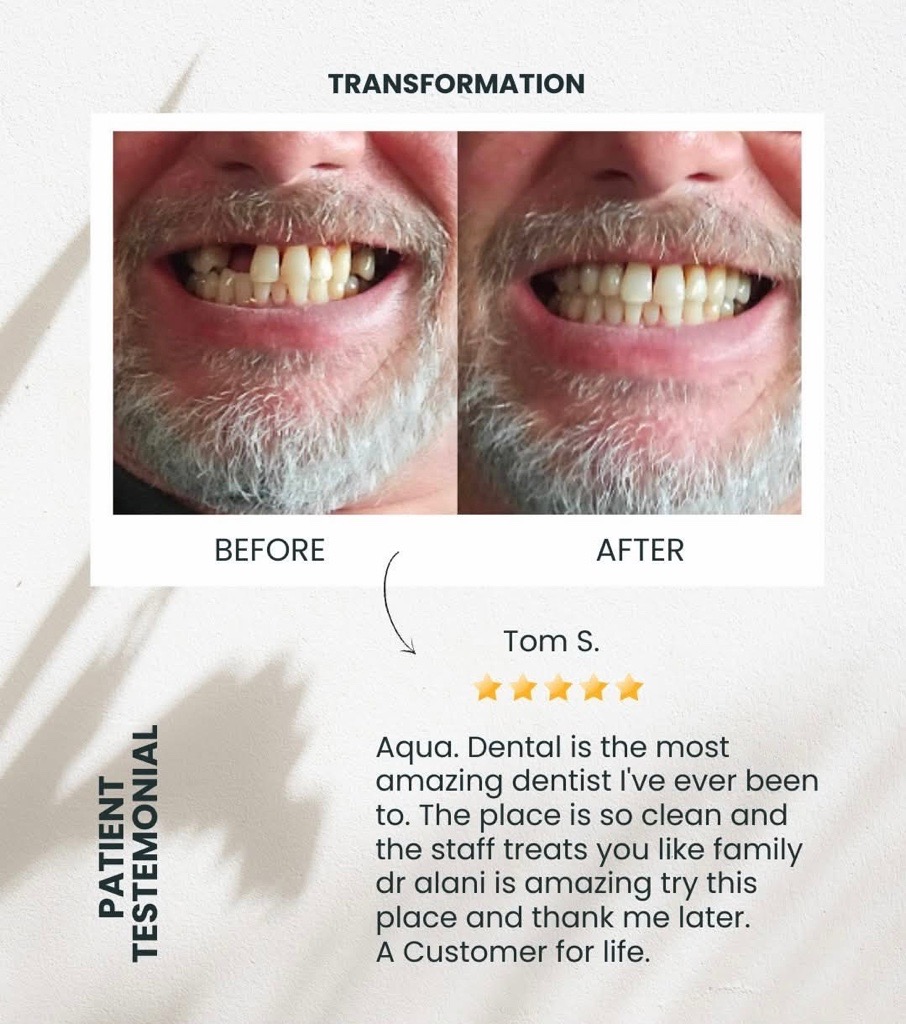 Before Afters dental image